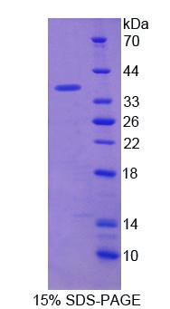 P2RX7 / P2X7 Protein - Recombinant Purinergic Receptor P2X, Ligand Gated Ion Channel 7 By SDS-PAGE