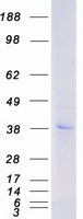 P2RY12 / P2Y12 Protein - Purified recombinant protein P2RY12 was analyzed by SDS-PAGE gel and Coomassie Blue Staining