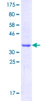 P2RY14 / GPR105 Protein - 12.5% SDS-PAGE Stained with Coomassie Blue.