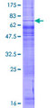 P2RY4 / P2Y4 Protein - 12.5% SDS-PAGE of human P2RY4 stained with Coomassie Blue
