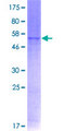 P2RY6 / P2Y6 Protein - 12.5% SDS-PAGE of human P2RY6 stained with Coomassie Blue