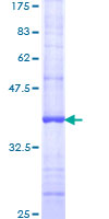 P2RY6 / P2Y6 Protein - 12.5% SDS-PAGE Stained with Coomassie Blue.