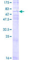 P2RY8 / P2Y8 Protein - 12.5% SDS-PAGE of human P2RY8 stained with Coomassie Blue