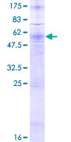 P2Y10 / P2RY10 Protein - 12.5% SDS-PAGE of human P2RY10 stained with Coomassie Blue