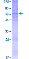 P2Y13 / P2RY13 Protein - 12.5% SDS-PAGE of human P2RY13 stained with Coomassie Blue