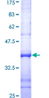 P3H1 / LEPRE1 Protein - 12.5% SDS-PAGE Stained with Coomassie Blue.