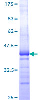 P40PHOX / NCF4 Protein - 12.5% SDS-PAGE Stained with Coomassie Blue.