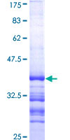 P450SCC / CYP11A1 Protein - 12.5% SDS-PAGE Stained with Coomassie Blue.