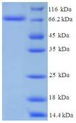 P450SCC / CYP11A1 Protein
