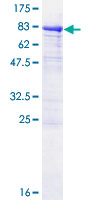 P4HA1 Protein - 12.5% SDS-PAGE of human P4HA1 stained with Coomassie Blue