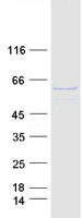 P4HA1 Protein - Purified recombinant protein P4HA1 was analyzed by SDS-PAGE gel and Coomassie Blue Staining