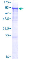 P4HA2 Protein - 12.5% SDS-PAGE of human P4HA2 stained with Coomassie Blue