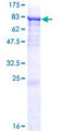 P4HA2 Protein - 12.5% SDS-PAGE of human P4HA2 stained with Coomassie Blue