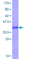 P4HA3 Protein - 12.5% SDS-PAGE Stained with Coomassie Blue.