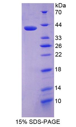 P4HA3 Protein - Recombinant Prolyl-4-Hydroxylase Alpha Polypeptide III By SDS-PAGE