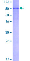 p56lck / LCK Protein - 12.5% SDS-PAGE of human LCK stained with Coomassie Blue