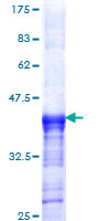 p56lck / LCK Protein - 12.5% SDS-PAGE Stained with Coomassie Blue.