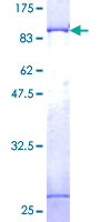 p58 / PSMD3 Protein - 12.5% SDS-PAGE of human PSMD3 stained with Coomassie Blue