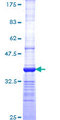 p58 / PSMD3 Protein - 12.5% SDS-PAGE Stained with Coomassie Blue.