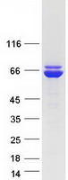 P5CDH / ALDH4A1 Protein - Purified recombinant protein ALDH4A1 was analyzed by SDS-PAGE gel and Coomassie Blue Staining