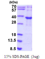 P5CR2 / PYCR2 Protein