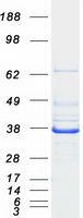 P5CR2 / PYCR2 Protein - Purified recombinant protein PYCR2 was analyzed by SDS-PAGE gel and Coomassie Blue Staining