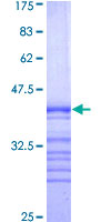 p66 / SHC Protein - 12.5% SDS-PAGE Stained with Coomassie Blue.