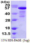 p66 / SHC Protein