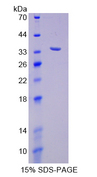 p66 / SHC Protein - Recombinant  SHC-Transforming Protein 1 By SDS-PAGE