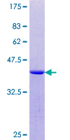p84 / THOC1 Protein - 12.5% SDS-PAGE Stained with Coomassie Blue.