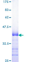 PA26 / SESN1 Protein - 12.5% SDS-PAGE Stained with Coomassie Blue.