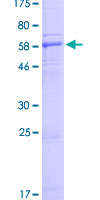 PAAF1 Protein - 12.5% SDS-PAGE of human PAAF1 stained with Coomassie Blue
