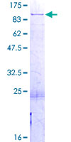 PABPC1 / PABP1 Protein - 12.5% SDS-PAGE of human PABPC1 stained with Coomassie Blue