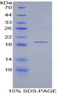 PABPC1L Protein - Recombinant Poly A Binding Protein Cytoplasmic 1 Like Protein By SDS-PAGE
