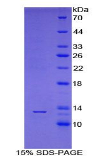 PABPC1L Protein - Recombinant Poly A Binding Protein Cytoplasmic 1 Like Protein By SDS-PAGE