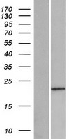PABPC1L2A Protein - Western validation with an anti-DDK antibody * L: Control HEK293 lysate R: Over-expression lysate