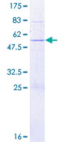 PABPC1L2A Protein - 12.5% SDS-PAGE of human PABPC1L2A stained with Coomassie Blue