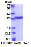 PABPN1 / PABP2 Protein