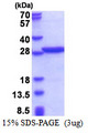 PABPN1 / PABP2 Protein