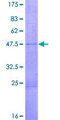 PACAP Protein - 12.5% SDS-PAGE of human ADCYAP1 stained with Coomassie Blue