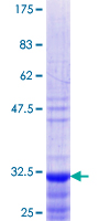 PACAP Protein - 12.5% SDS-PAGE Stained with Coomassie Blue.