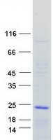 PACAP Protein - Purified recombinant protein ADCYAP1 was analyzed by SDS-PAGE gel and Coomassie Blue Staining