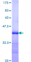 PACE4 / PCSK6 Protein - 12.5% SDS-PAGE Stained with Coomassie Blue.