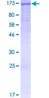 PACS2 Protein - 12.5% SDS-PAGE of human PACS2 stained with Coomassie Blue