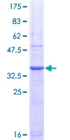PAD2 / PADI2 Protein - 12.5% SDS-PAGE Stained with Coomassie Blue.