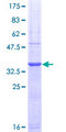 PAD2 / PADI2 Protein - 12.5% SDS-PAGE Stained with Coomassie Blue.