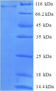 PAD2 / PADI2 Protein