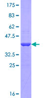 PADI1 Protein - 12.5% SDS-PAGE Stained with Coomassie Blue.