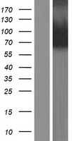 PADI3 Protein - Western validation with an anti-DDK antibody * L: Control HEK293 lysate R: Over-expression lysate