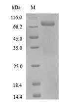 PADI3 Protein - (Tris-Glycine gel) Discontinuous SDS-PAGE (reduced) with 5% enrichment gel and 15% separation gel.